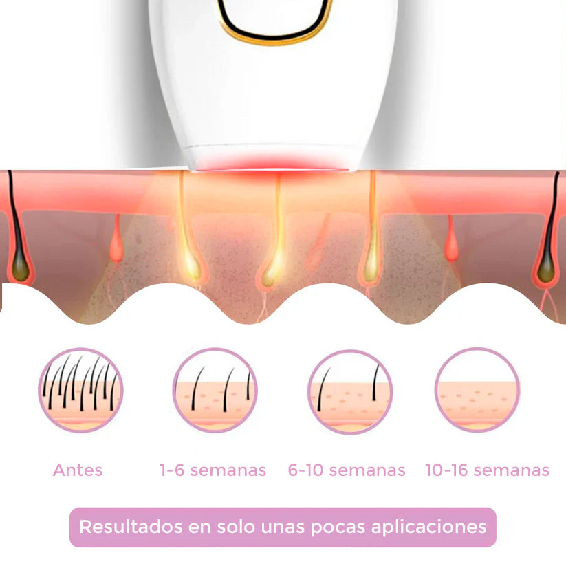 IPL Removedor de Vello | La mejor depiladora láser para usar en casa